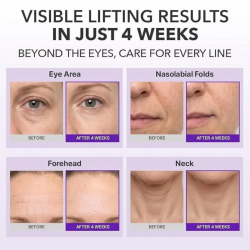 Centellian24 - 360º Shot PDRN Lifting Eye Cream (30ml)