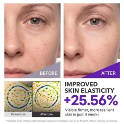 Centellian24 - Expert Madeca Cream Active Renew PDRN (50ml)
