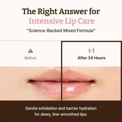 Dr. Reju-All - Advanced PDRN Rejuvenating Lip Serum (10ml)