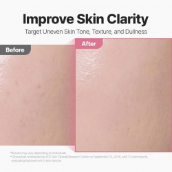P.CALM - Red Rice Glow Peel Shot 8 Serum (80ml)